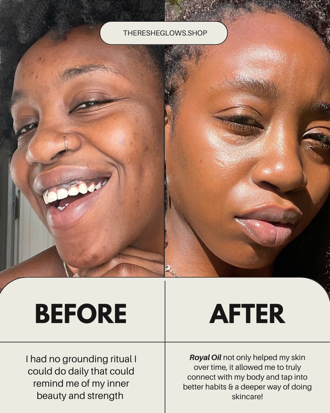 Royal Oil Facial Cleanser